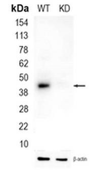 MVD Rabbit Monoclonal Antibody