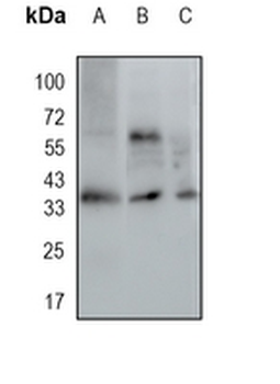 SPFH2 Rabbit Monoclonal Antibody