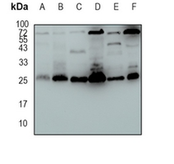 SLC31A1 Rabbit Monoclonal Antibody