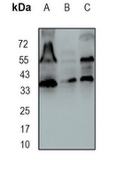HDGF Rabbit Monoclonal Antibody