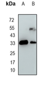 UPase 1 Rabbit Monoclonal Antibody