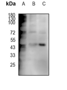 Caspase 1 Rabbit Monoclonal Antibody