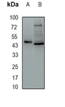 SCCA1 Rabbit Monoclonal Antibody