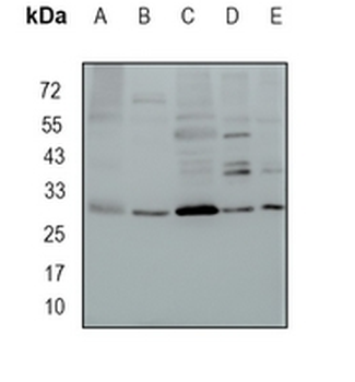 MRPL28 Rabbit Monoclonal Antibody