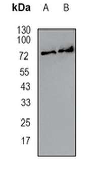 CARS Rabbit Monoclonal Antibody