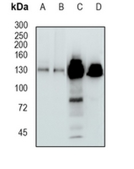 UBE4B Rabbit Monoclonal Antibody