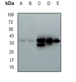 QKI Rabbit Monoclonal Antibody