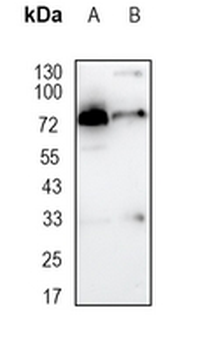 TRMT2A Rabbit Monoclonal Antibody