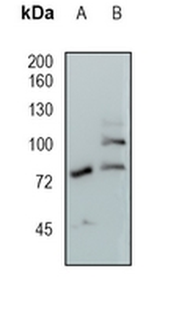 GAA Rabbit Monoclonal Antibody