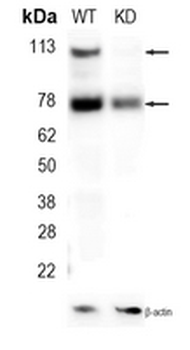 GAA Rabbit Monoclonal Antibody