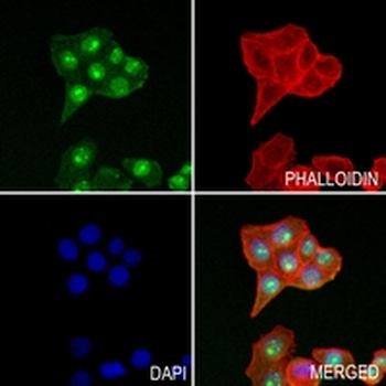 RPL7A Rabbit Monoclonal Antibody