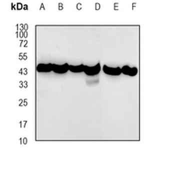 RIPK1 (Cleaved-D324) Rabbit Monoclonal Antibody