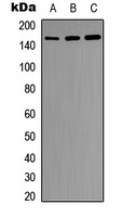 Insulin Receptor Rabbit Polyclonal Antibody
