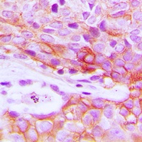 Insulin Receptor Rabbit Polyclonal Antibody