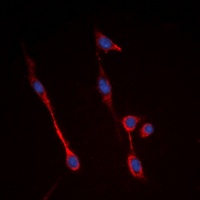 Insulin Receptor Rabbit Polyclonal Antibody