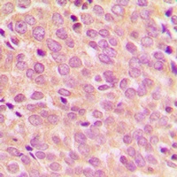 Anti-IRS1 (Phospho-S794) Antibody