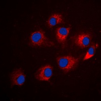 Anti-IRS1 (Phospho-S794) Antibody