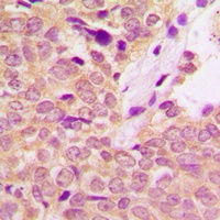 Anti-IRS1 Antibody