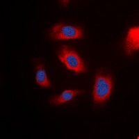 Anti-IRS1 Antibody