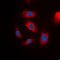 IRS1 antibody