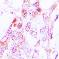 Anti-JAK3 Antibody