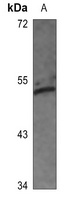 c-Jun (Phospho-S63) Antibody