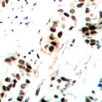 c-Jun (Phospho-S73/100) antibody