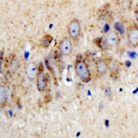 Anti-Kir3.1 (Phospho-S185) Antibody