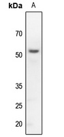 Kir3.1 Rabbit Polyclonal Antibody