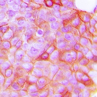 Anti-VEGFR2 (Phospho-Y951) Antibody