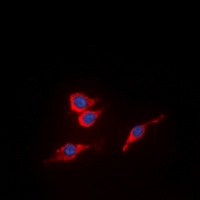 VEGFR2 (Phospho-Y951) antibody