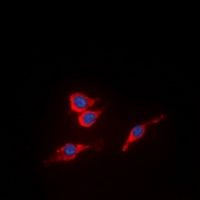 Anti-VEGFR2 (Phospho-Y951) Antibody