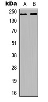VEGFR2 Rabbit Polyclonal Antibody