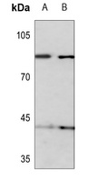 KIF2C (Phospho-S95) Antibody