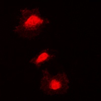 KIF2C (Phospho-S95) antibody