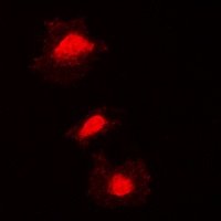 KIF2C (Phospho-S95) Antibody