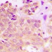 Anti-Cytokeratin 8 (Phospho-S432) Antibody