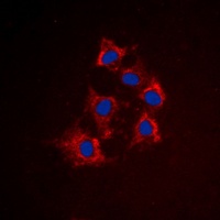 Anti-Cytokeratin 8 (Phospho-S432) Antibody