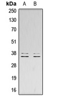 LAT (Phospho-Y200) Antibody