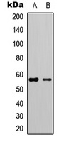 LCK (Phospho-Y505) Rabbit Polyclonal Antibody