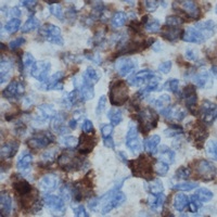 LCK (Phospho-Y505) Rabbit Polyclonal Antibody