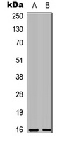 Galectin 7 Antibody