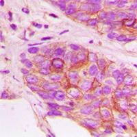 Anti-MKK3 (Phospho-T222) Antibody