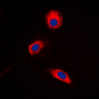 Anti-MKK3 (Phospho-T222) Antibody