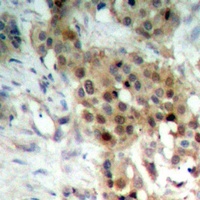 Anti-MKK4 Antibody