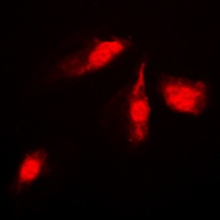 Anti-MKK4 Antibody
