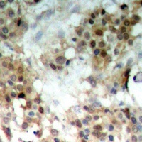 Anti-MKK7 (Phospho-S271) Antibody