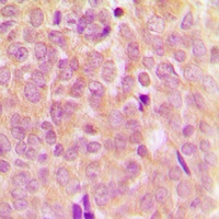 Anti-ASK1 (Phospho-S83) Antibody