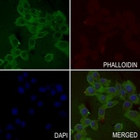 Anti-ASK1 (Phospho-S83) Antibody