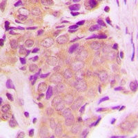 Anti-TAK1 (Phospho-T184) Antibody
